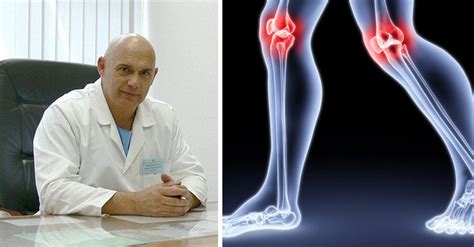 лечение на артроза на коляното според Бубновски